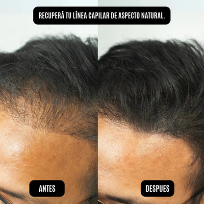 Polvo Capilar HairGo Negro 4g - Rellenador Premium Resistente al Agua y Sudor